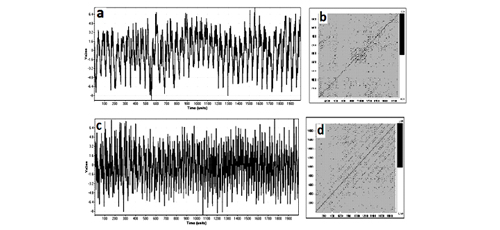 Investigating the Machinability of Metallic Matrix Composites Reinforced by Carbon Nanotubes: A Review 