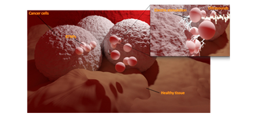 Piezo-therapy in cancer: Current research and perspectives