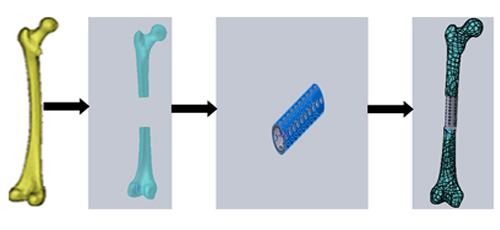 Design, 3D Development and Finite Element Analysis of Cylindrical Mesh Cage Bioimplants from Biometals