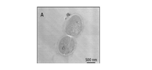 Uptake and toxicity of different nanoparticles towards a tough bacterium: Deinococcus radiodurans 